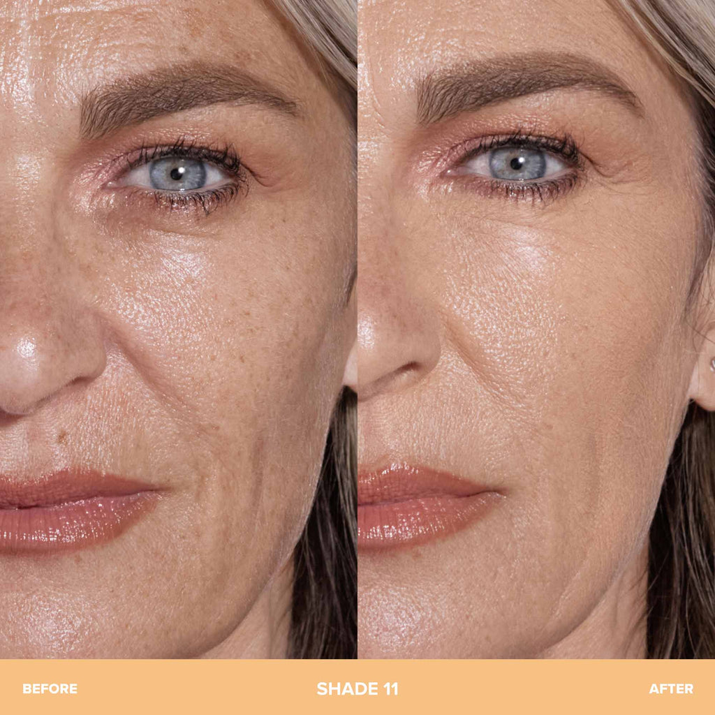 11 | Before and After 11