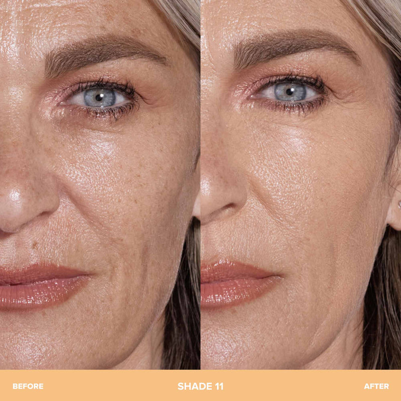 11 | Before and After 11